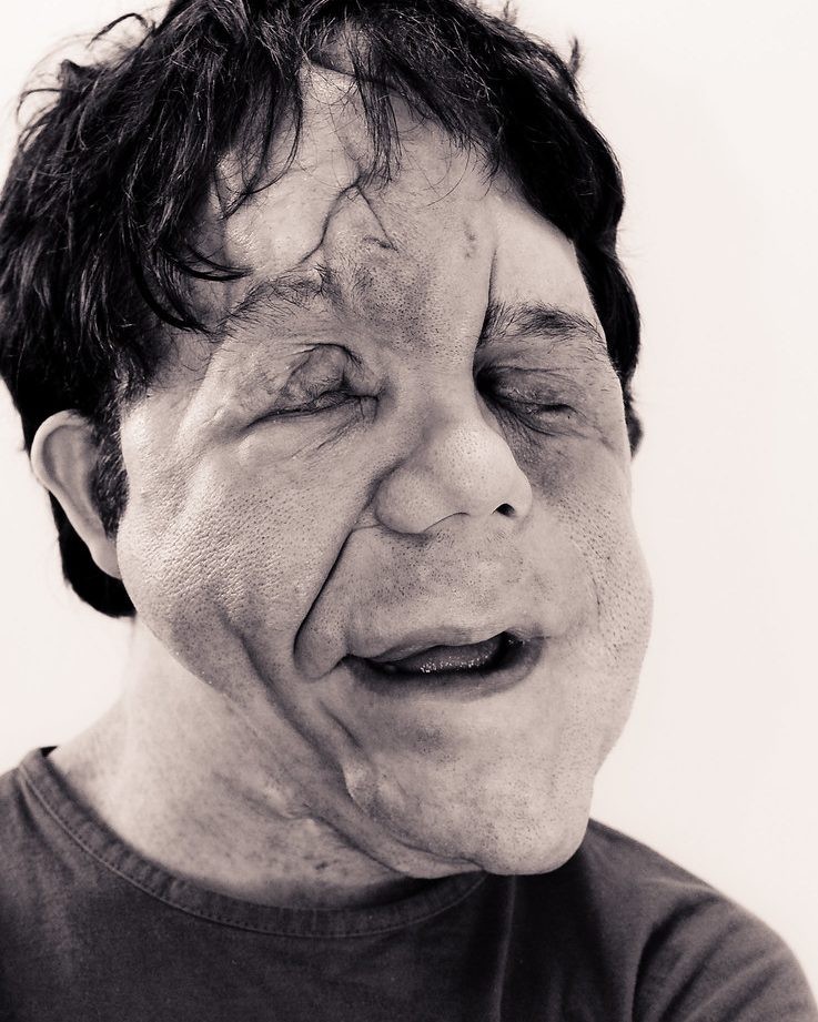 You are currently viewing Adam Pearson