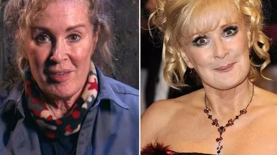 Beverley Callard