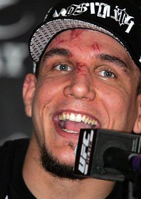 Frank Mir