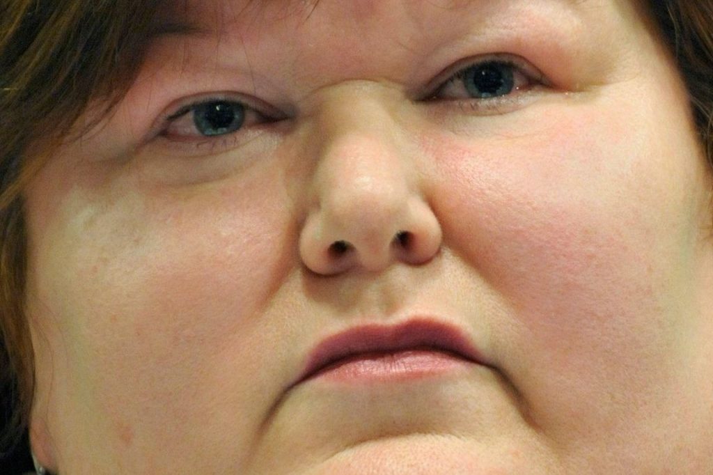 Maggie De Block