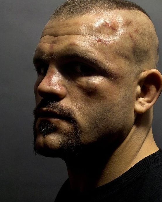 Chuck Liddell